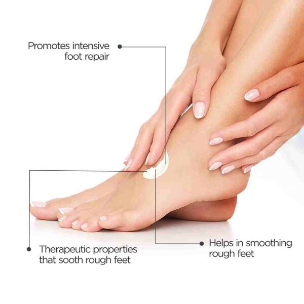 Best Natural Foot Cream for Cracked Heels – Icawnic